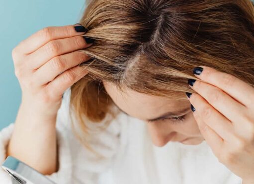 التخلص من القشرة نهائياً